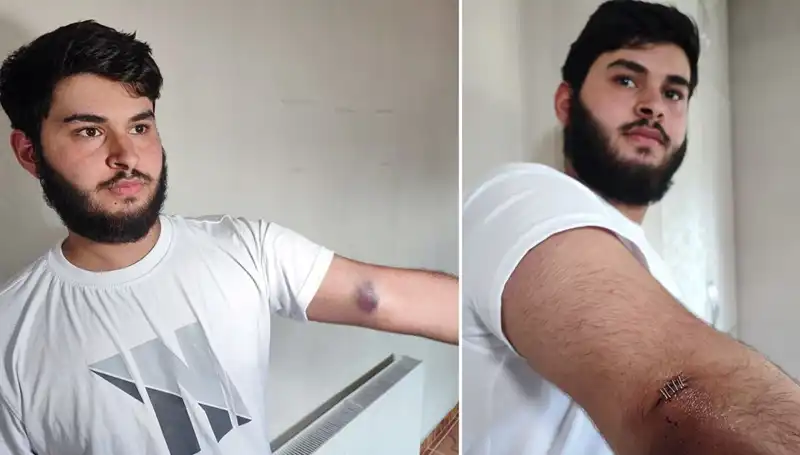 Bahçeye Kaçan Top, Mahallede Neler Oldu? Conolar Kamyonetle Geldi!