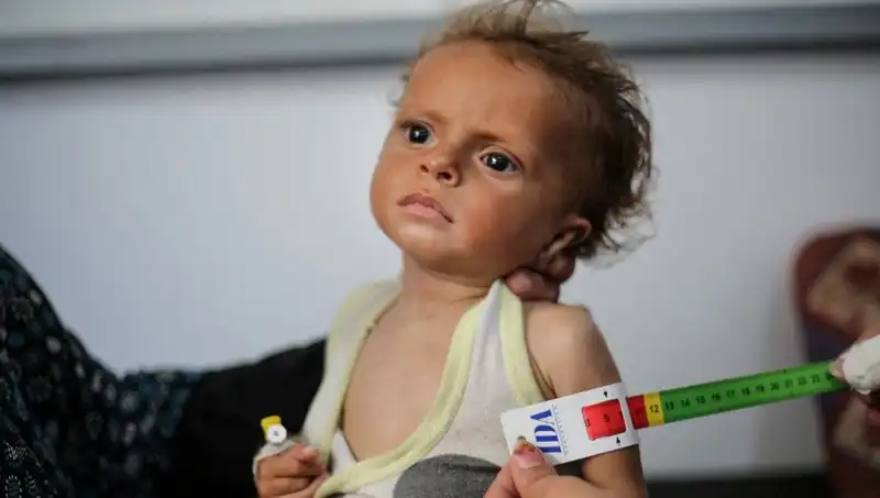 İngiltere, 300 Gazzeli Çocuğa Gelecek Vaadediyor: Yeni Bir Umut Kapısı