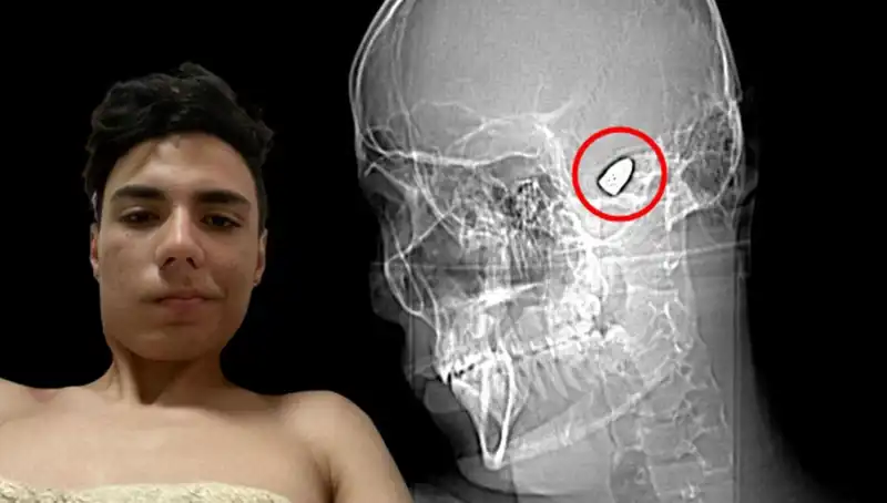 Hayatında Patlayan Bomba: Kafasında Tehlikeli Bir Gizem Barındırıyor